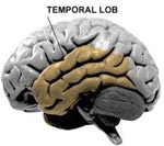 temporal